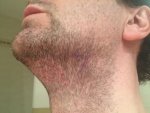 Beard Donor 05 Cleaned.jpg