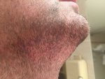 Beard Donor 06 Cleaned.jpg