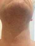Beard Donor 01.jpg