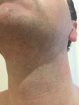 Beard Donor 02.jpg