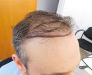 thumbnail_1. Before - right.jpg