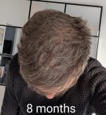 thumbnail_7.  8 Months after top View.jpg