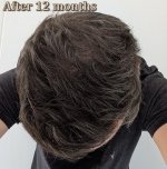 thumbnail_8. One year After top view.jpg