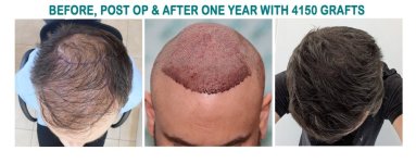thumbnail_12 Comparison 2.jpg