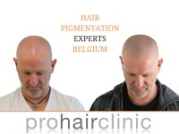 HAIR PIGMENTATION EXPERTS BELGIUM.jpg