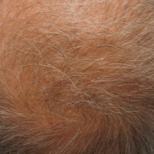 3851_261836_100000004.jpg