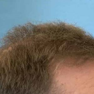 thumbnail_IMG_7244d.jpg