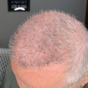 Front Side_Left Tilt Down.jpg