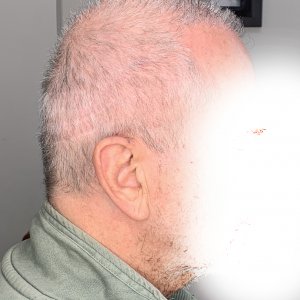 Side_Right_1.jpg