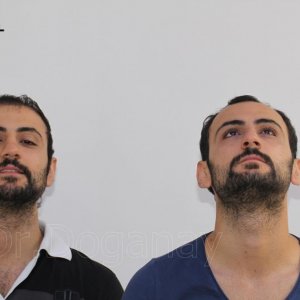 Identical twin hair transplant 35.jpg