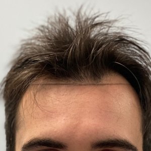 before-dr-nikos.jpg