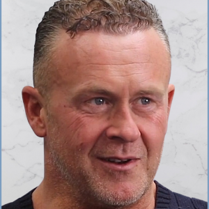 Dr-Nikos-hair-transplant-result.1.png
