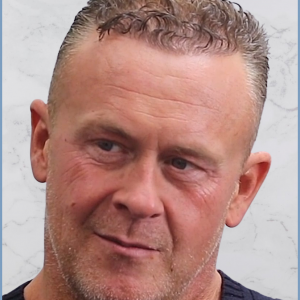 Dr-Nikos-hair-transplant-result.png