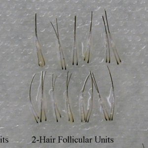 Follicular-Units-1024x456.jpg