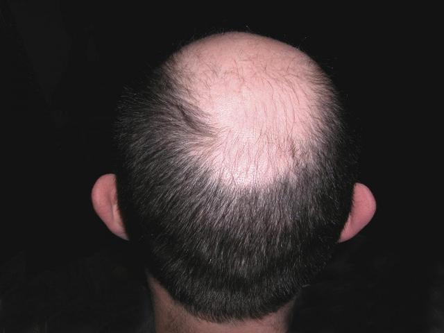 1_061200_350000004.jpg
