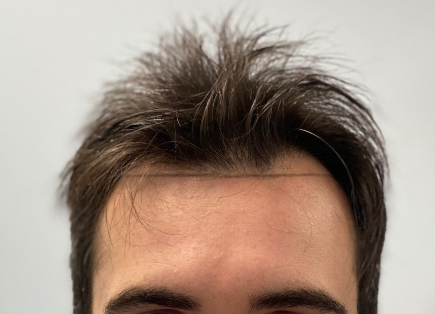 before-dr-nikos.jpg