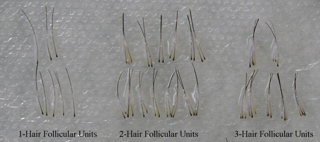 Follicular-Units-1024x456.jpg