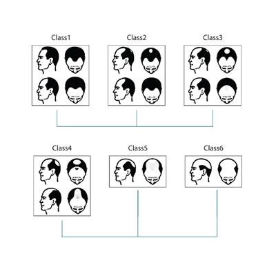 How Can One Decide What Amount Of Hair Is Required to Cover The Scalp?